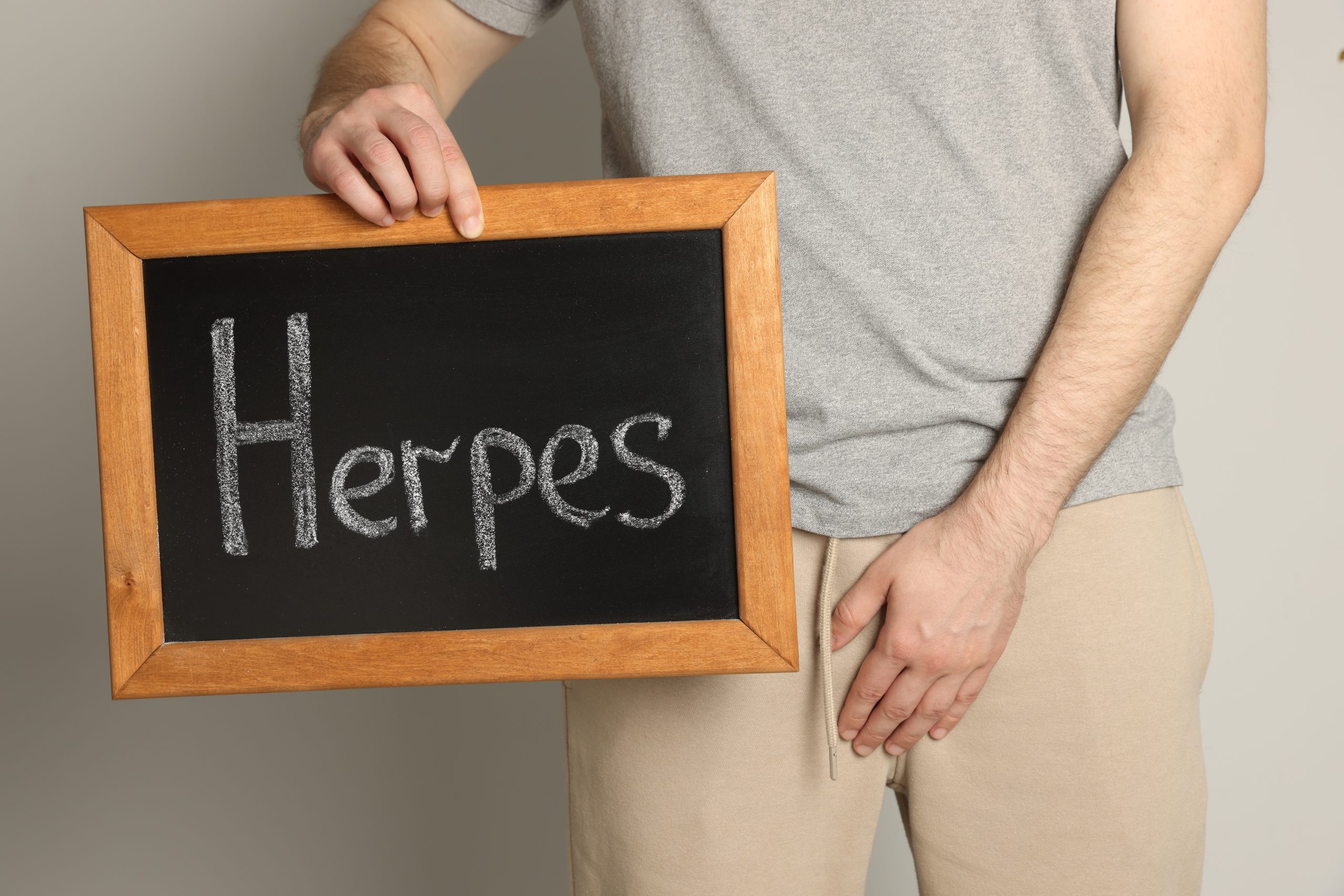 How To Get Rid Of Herpes Asap